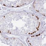 ERICH6 Antibody in Immunohistochemistry (Paraffin) (IHC (P))