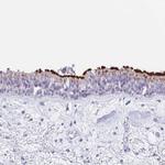 CPXM2 Antibody in Immunohistochemistry (IHC)