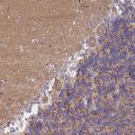 AP3M1 Polyclonal Antibody