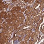 PRR32 Polyclonal Antibody