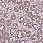 HERC2 Antibody in Immunohistochemistry (Paraffin) (IHC (P))