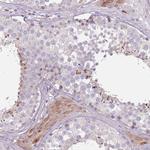 SPAG4 Polyclonal Antibody