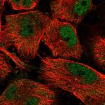 SH3RF3 Polyclonal Antibody