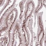 SH3RF3 Antibody in Immunohistochemistry (IHC)