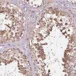 KIAA1257 Antibody in Immunohistochemistry (Paraffin) (IHC (P))
