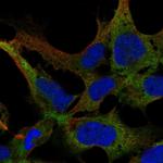 KIAA1257 Polyclonal Antibody