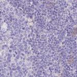 LZTFL1 Antibody in Immunohistochemistry (IHC)