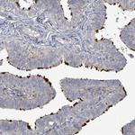 CCDC173 Polyclonal Antibody