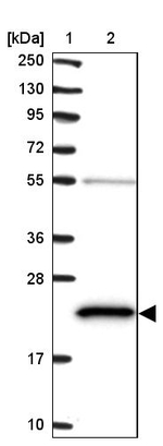 ATP5H Antibody in Western Blot (WB)