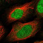 DBF4B Polyclonal Antibody