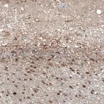 TMEM255A Antibody in Immunohistochemistry (Paraffin) (IHC (P))