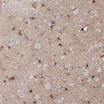 TMEM255A Polyclonal Antibody