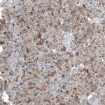 TMEM255A Antibody in Immunohistochemistry (Paraffin) (IHC (P))
