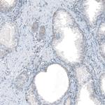 TMEM255A Antibody in Immunohistochemistry (Paraffin) (IHC (P))
