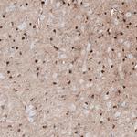 TMEM255A Antibody in Immunohistochemistry (Paraffin) (IHC (P))