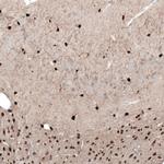 TMEM255A Antibody in Immunohistochemistry (Paraffin) (IHC (P))