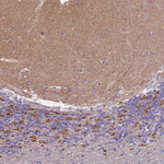 COL27A1 Antibody in Immunohistochemistry (Paraffin) (IHC (P))