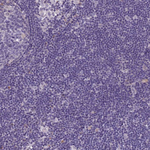 COL27A1 Polyclonal Antibody