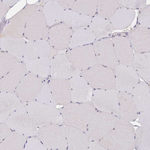 COL27A1 Antibody in Immunohistochemistry (Paraffin) (IHC (P))
