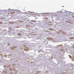 COL27A1 Antibody in Immunohistochemistry (IHC)