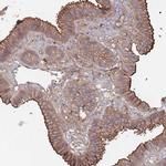 PLEKHA4 Antibody in Immunohistochemistry (IHC)