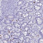 MYADML2 Polyclonal Antibody