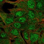 ERICH4 Polyclonal Antibody