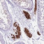ERICH4 Antibody in Immunohistochemistry (Paraffin) (IHC (P))