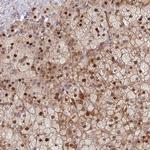 TMEM90A Polyclonal Antibody