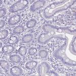 RHBG Antibody in Immunohistochemistry (Paraffin) (IHC (P))