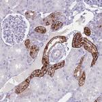 RHBG Antibody in Immunohistochemistry (Paraffin) (IHC (P))