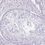 RHBG Antibody in Immunohistochemistry (Paraffin) (IHC (P))