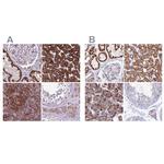 GCDH Polyclonal Antibody