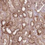 ANKRD24 Antibody in Immunohistochemistry (Paraffin) (IHC (P))