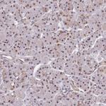 SNRPA1 Antibody in Immunohistochemistry (Paraffin) (IHC (P))