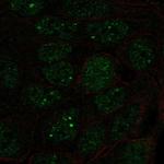 SNRPA1 Polyclonal Antibody