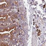 NLRP6 Antibody in Immunohistochemistry (Paraffin) (IHC (P))