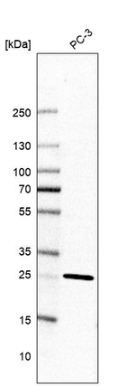 TMEM55B Antibody in Western Blot (WB)
