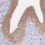 TMEM55B Polyclonal Antibody