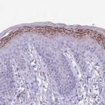 CLEC2A Polyclonal Antibody