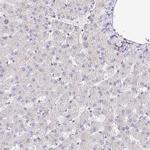 Nhe-1 Antibody in Immunohistochemistry (IHC)