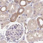 Nhe-1 Antibody in Immunohistochemistry (IHC)