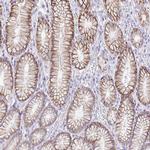 Nhe-1 Antibody in Immunohistochemistry (IHC)