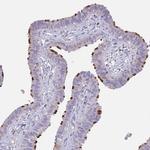 CCDC42B Antibody in Immunohistochemistry (IHC)