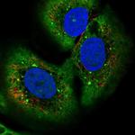 TMEM27 Polyclonal Antibody