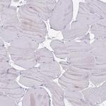 TMEM251 Antibody in Immunohistochemistry (Paraffin) (IHC (P))