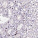 TMEM251 Polyclonal Antibody