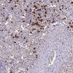 TMEM251 Antibody in Immunohistochemistry (IHC)