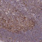 ASAP1 Antibody in Immunohistochemistry (Paraffin) (IHC (P))