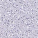 TMM35 Antibody in Immunohistochemistry (IHC)